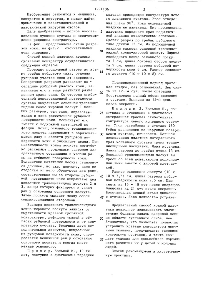 Способ лечения послеожоговых краевых суставных контрактур (патент 1291136)