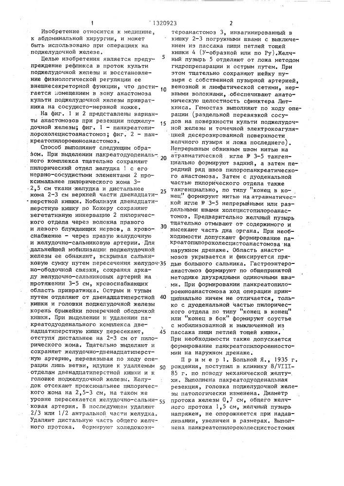 Способ панкреатодуоденальной резекции (патент 1320923)