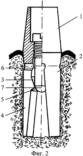 Зубной имплантат бутовского-родионова (патент 2356515)