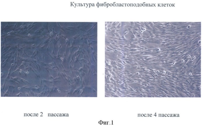 Способ получения фибробластоподобных клеток из пупочного канатика новорожденного (патент 2384618)