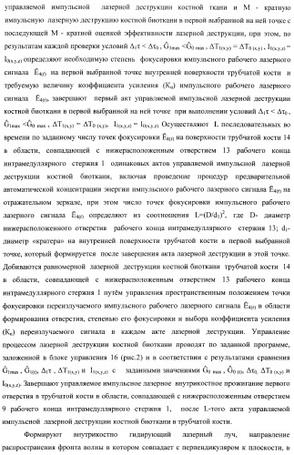 Способ дистального блокирования интрамедуллярных стержней при остеосинтезе длинных трубчатых костей и устройство для его осуществления (патент 2387401)