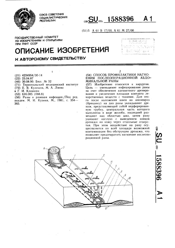 Способ профилактики нагноения послеоперационной абдоминальной раны (патент 1588396)