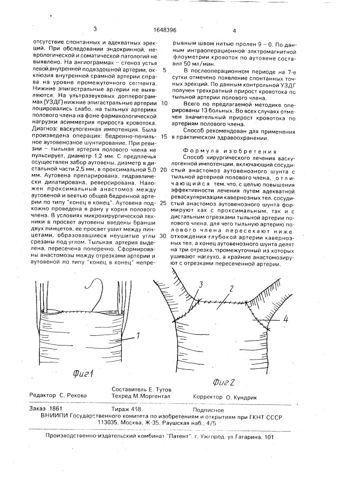 Способ хирургического лечения васкулогенной импотенции (патент 1648396)