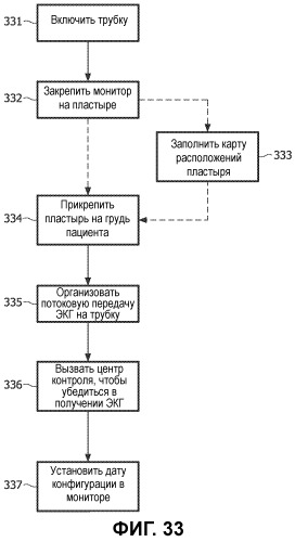 Система контроля экг с беспроводной связью (патент 2501520)