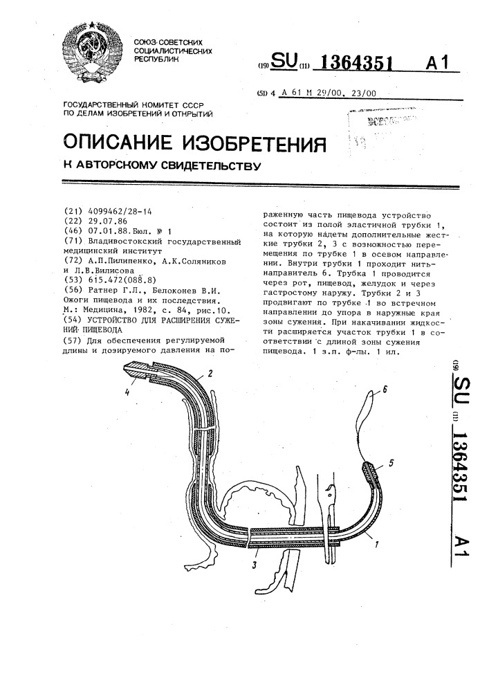 Масло для пищевода. Защитные механизмы пищевода. Питание через трубку при сужении пищевода.