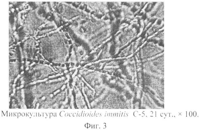 Способ приготовления живых препаратов микроскопических грибов рода coccidioides для световой микроскопии (патент 2496863)