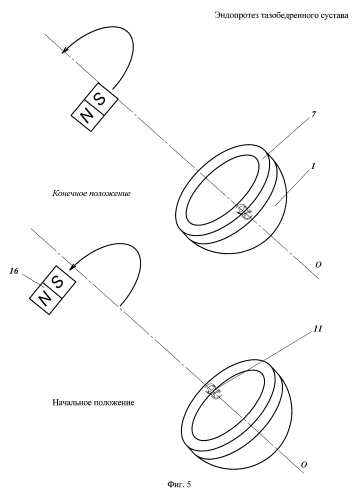 Эндопротез тазобедренного сустава (патент 2589612)