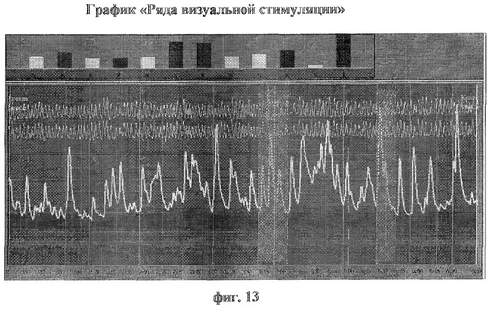 Способ диагностики нарушений сексуальных предпочтений (патент 2283029)