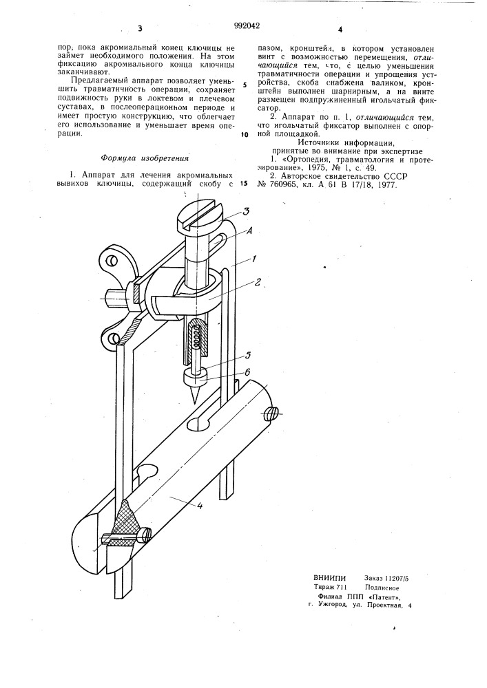 Аппарат для лечения акромиальных вывихов ключицы (патент 992042)