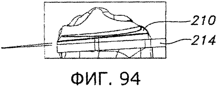 Способы и устройства для артропластики коленного сустава (патент 2570163)
