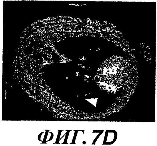 Способы и композиции для модуляции и обнаружения активности wisp (патент 2412201)