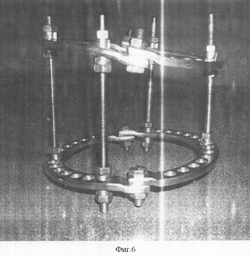 Аппарат внешней фиксации для интраоперационной репозиции и стабилизации положения посттравматических отломков костей (патент 2314767)