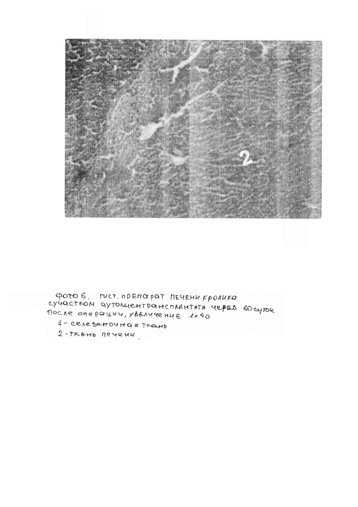 Способ экспериментального моделирования аутотрансплантации селезеночной ткани в печень (патент 2610361)