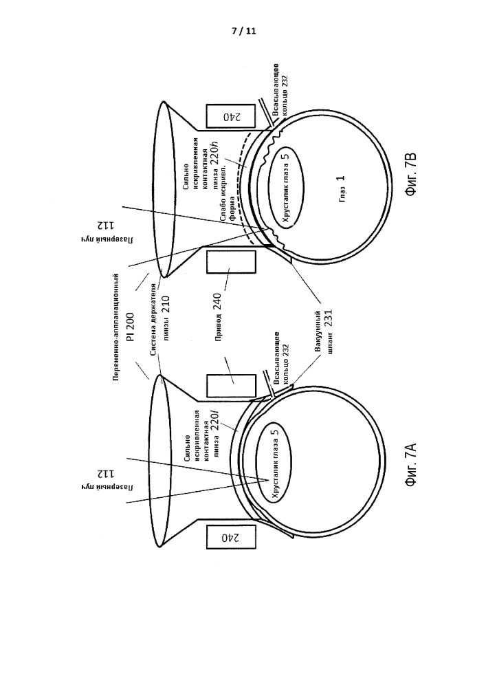 Интерфейс пациента с переменной аппланацией (патент 2621592)