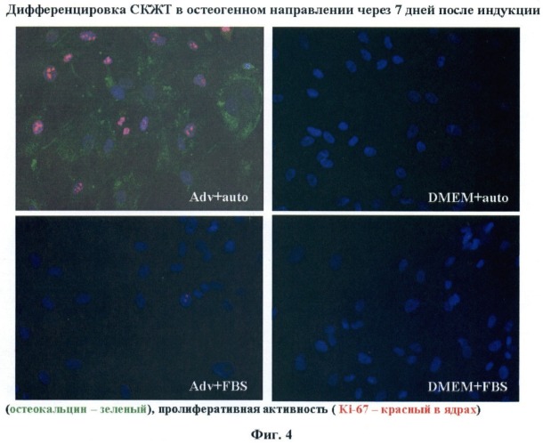Среда культивирования мультипотентных стромальных клеток из жировой ткани человека и способ культивирования этих клеток с ее использованием (патент 2418855)