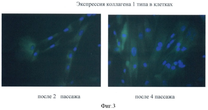 Способ получения фибробластоподобных клеток из пупочного канатика новорожденного (патент 2384618)