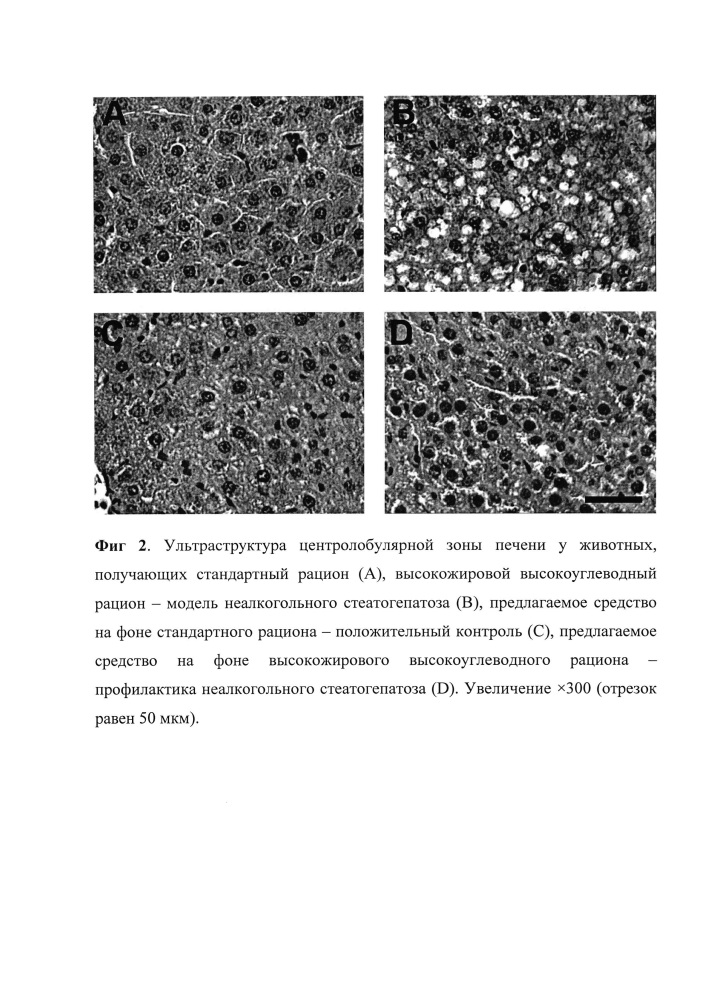 Средство для лечения и профилактики неалкогольной жировой болезни печени (патент 2644282)