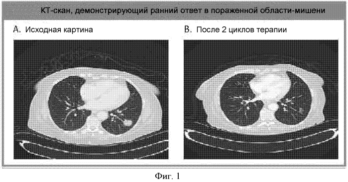 Способы лечение рака поджелудочной железы (патент 2576609)
