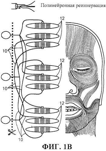 Система и способ стимуляции лицевого нерва (патент 2511082)