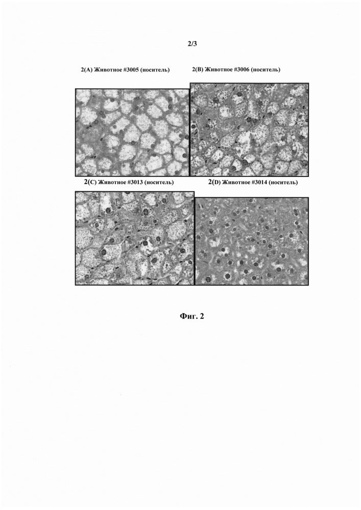 Способ улучшения функции печени (патент 2653478)