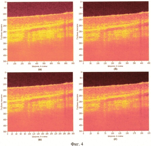 Способ повышения качества структурного изображения биообъекта в оптической когерентной томографии (патент 2530300)