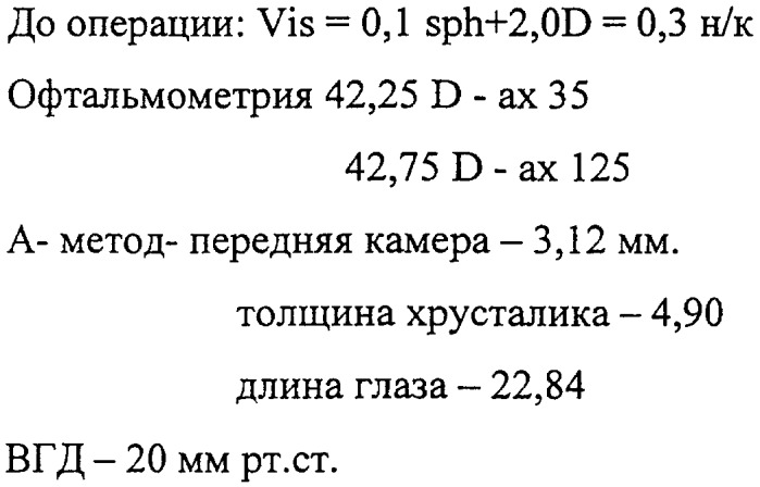 Способ определения показаний к выбору метода анестезии при микрохирургических операциях по поводу катаракты при наличии сопутствующей патологии сетчатки макулярной области (патент 2357706)