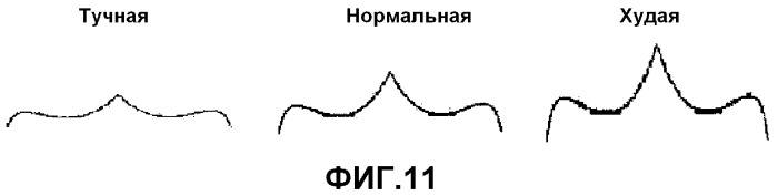 Устройство и способ определения количественного показателя состояния тела животного (патент 2543948)