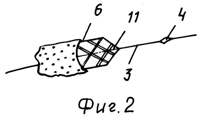 Устройство для защиты сосудов малого диаметра (патент 2294714)