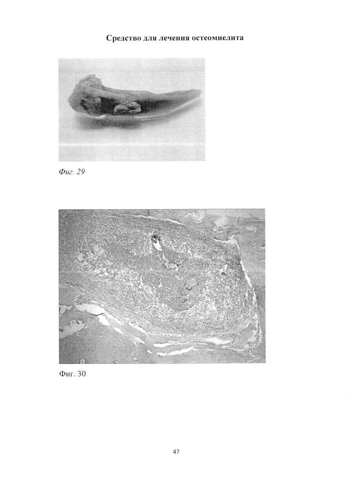 Средство для лечения остеомиелита (патент 2604124)