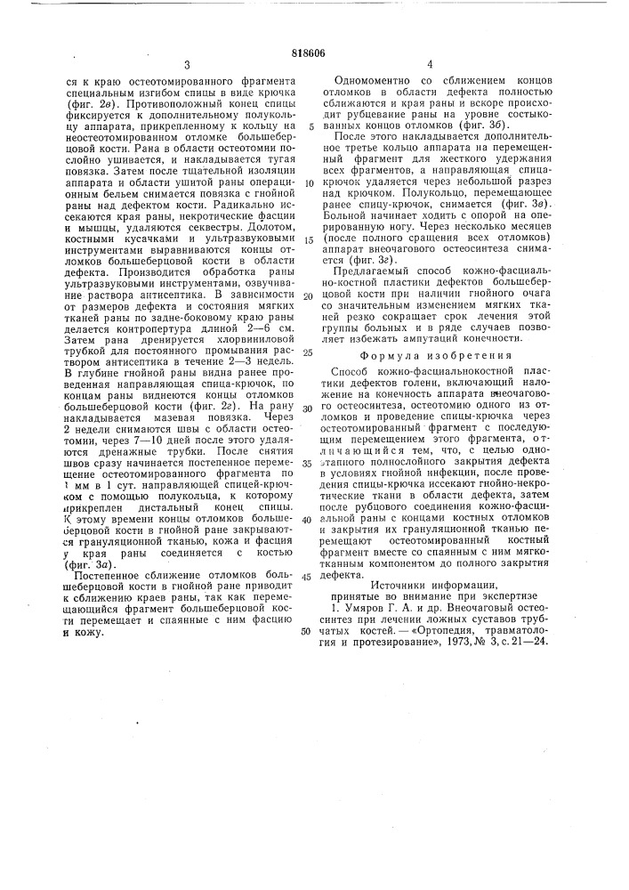 Способ кожно-фасциальнокостнойпластики дефектов голени (патент 818606)