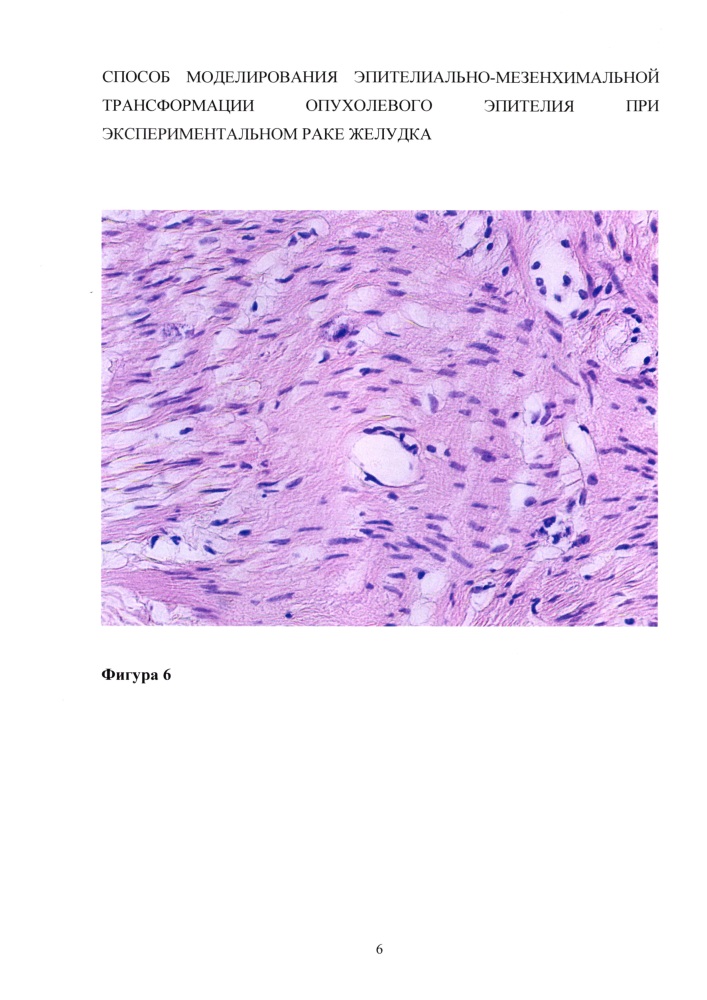 Способ моделирования эпителиально-мезенхимальной трансформации опухолевого эпителия при экспериментальном раке желудка (патент 2626717)