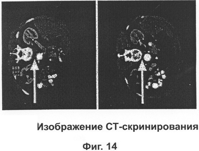 Обладающий питательными свойствами фармацевтический состав на основе полифенолов и его использование при лечении рака (патент 2301666)