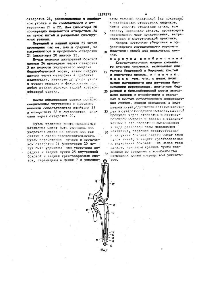 Костно-связочная модель коленного сустава человека (патент 1529278)