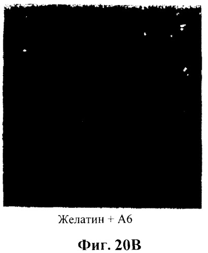 Захват эндотелиальных клеток-предшественников элюирующим лекарственные средства имплантируемым медицинским устройством (патент 2400256)