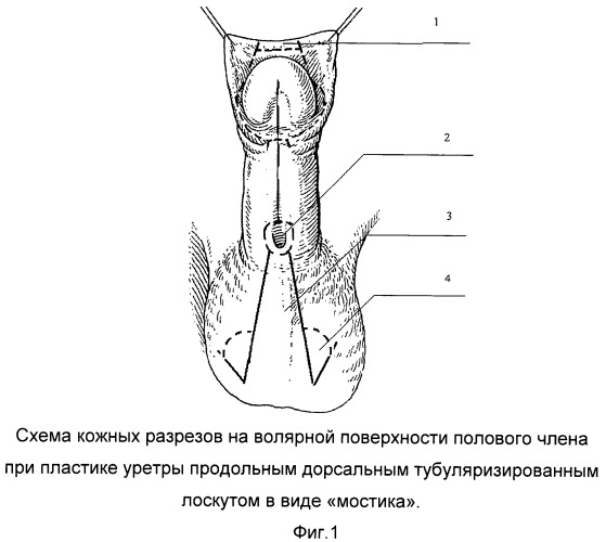 Схема полового члена