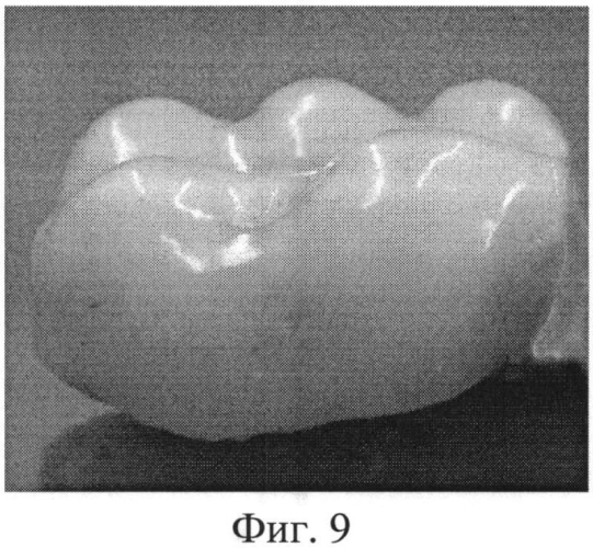 Способ изготовления металлокерамических зубных протезов (патент 2551628)