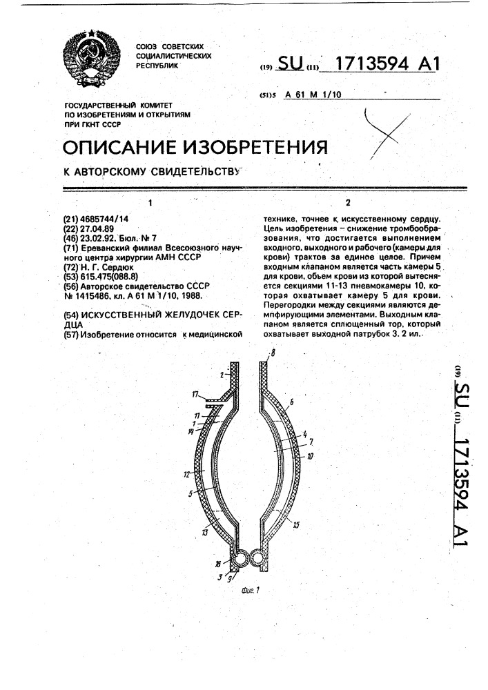 Искусственный желудочек сердца (патент 1713594)