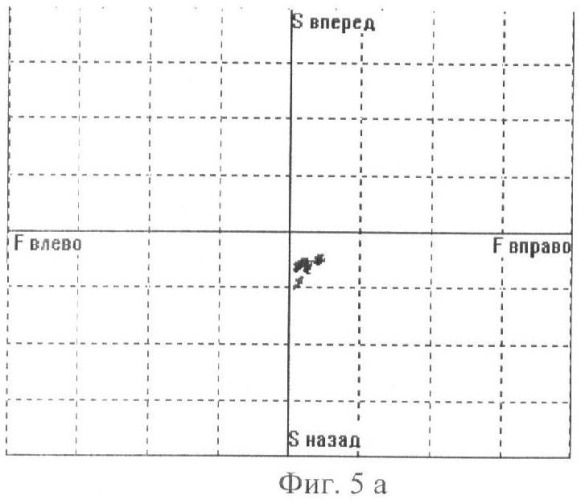 Способ формирования устойчивости в позе сидя у пациентов со статодинамическими нарушениями (патент 2448670)