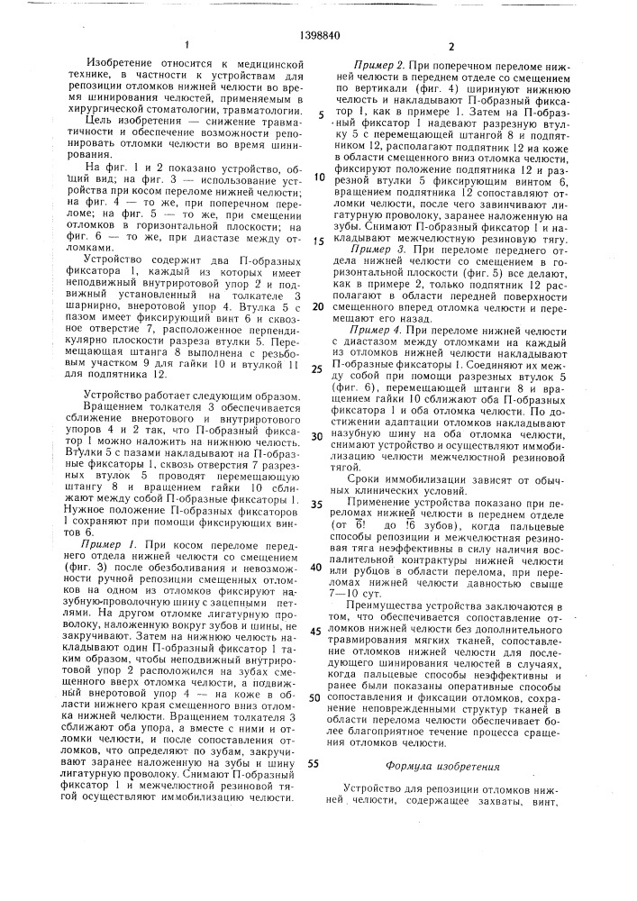 Устройство для репозиции отломков нижней челюсти (патент 1398840)