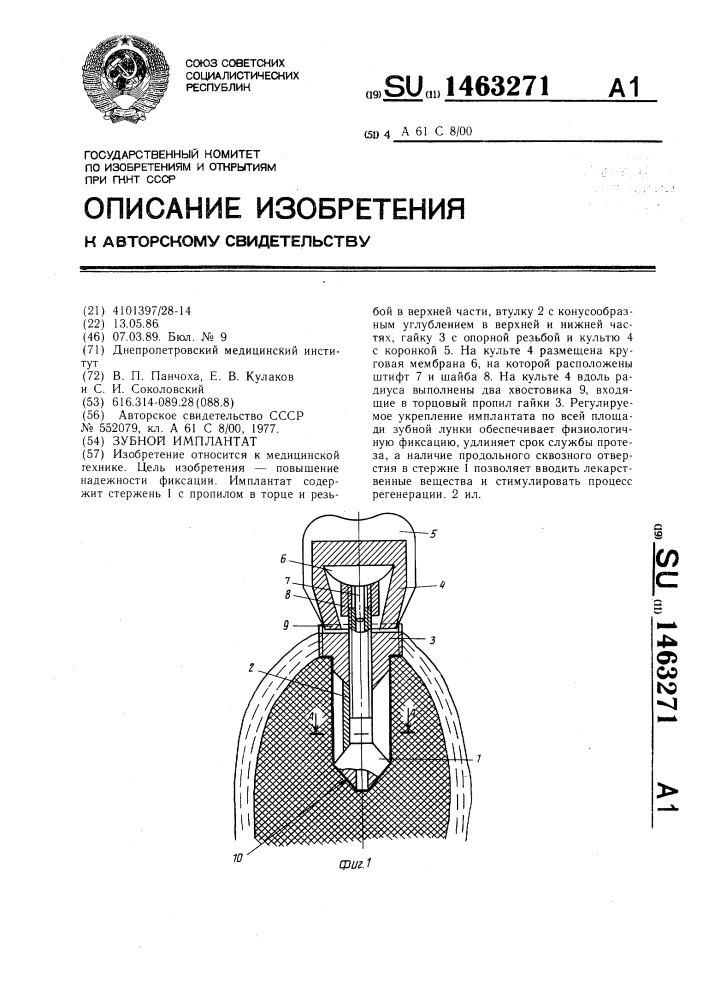 Зубной имплантат (патент 1463271)
