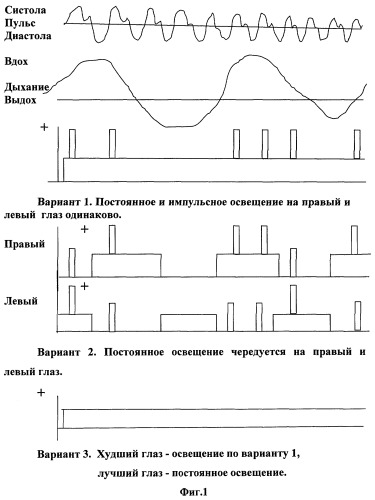 Способ восстановления зрительных функций (патент 2252733)