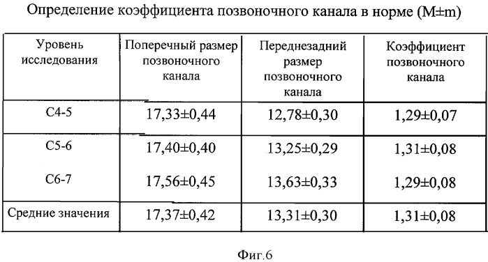 Сагиттальный размер шейного отдела