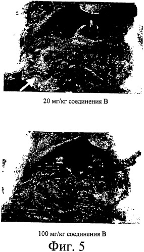 Регулирование содержания жира (патент 2397766)
