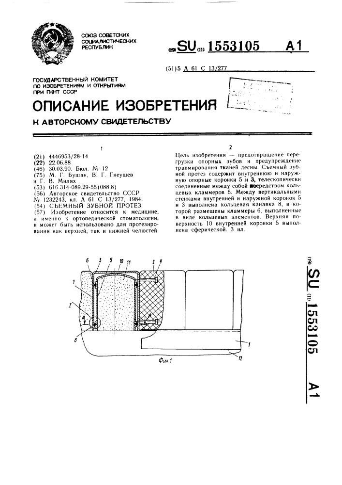 Съемный зубной протез (патент 1553105)