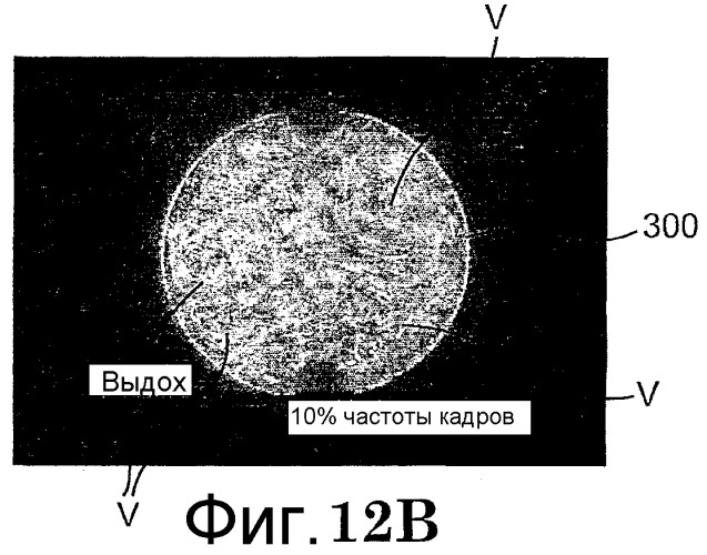 Носовое устройство и система непрерывного положительного давления в дыхательных путях (патент 2420325)