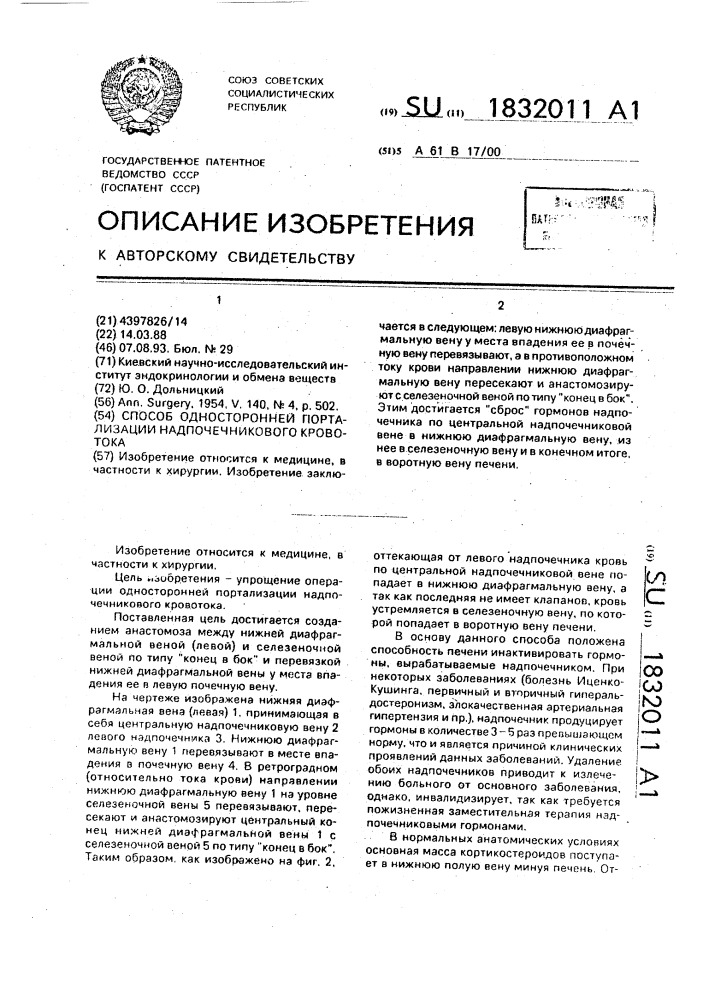 Способ односторонней портализации надпочечникового кровотока (патент 1832011)