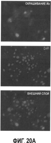 Вакцины на основе свиного вируса torque teno и способы диагностики инфекций, вызванных этим вирусом (патент 2553223)
