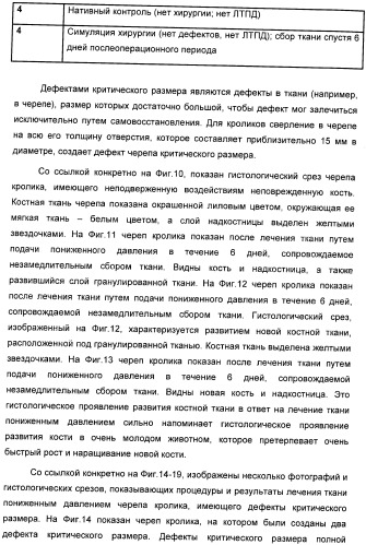 Система и способ продувки устройства пониженного давления во время лечения путем подачи пониженного давления (патент 2404822)