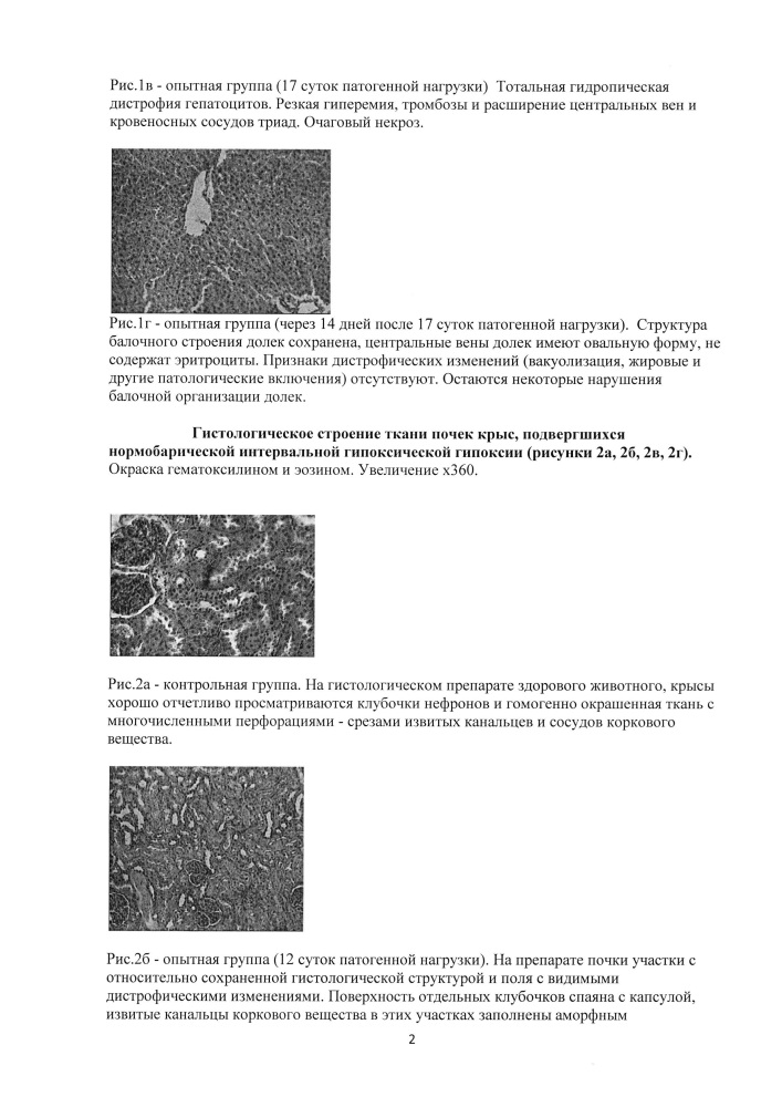Способ моделирования вторичного постгипоксического иммунодефицита по дисрегуляторному типу с транзиторной недостаточностью cd4-позитивных лимфоцитов (патент 2609281)