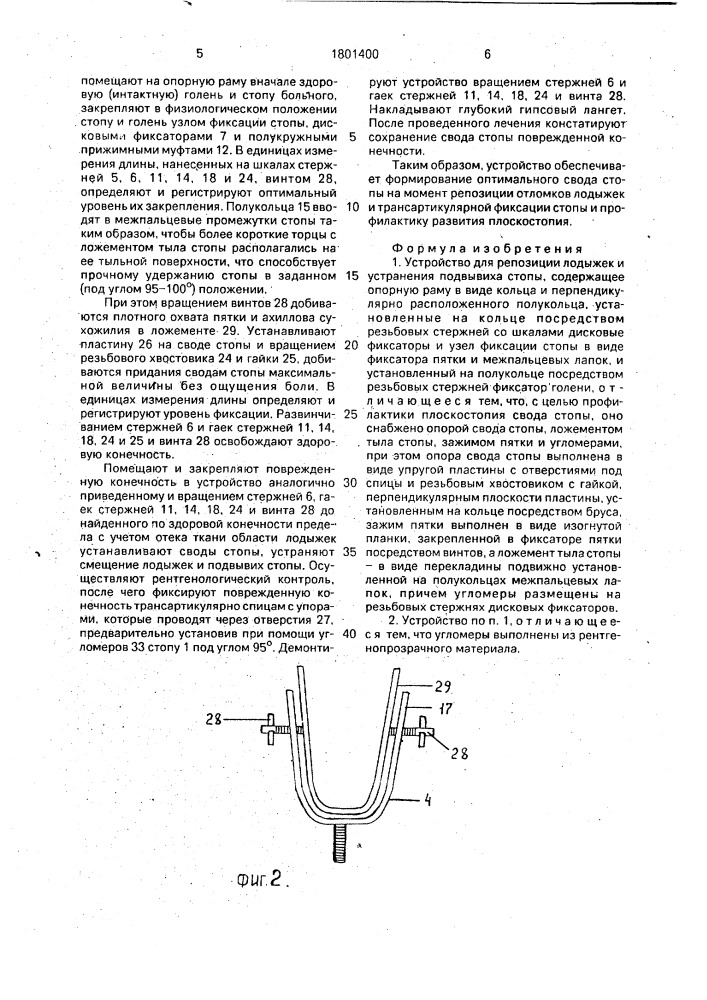 Устройство для репозиции лодыжек и устранения подвывиха стопы (патент 1801400)